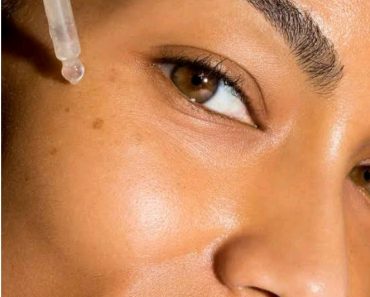 5 Ways To Remove Dark Spots From Your Body