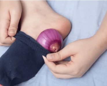 See, Sleeping With An Onion On Your Feet Has These Health Advantages.