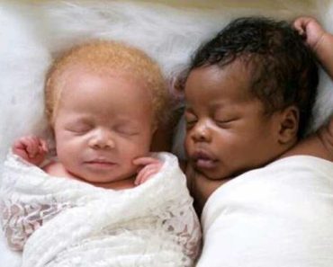 BREAKING: A photographer gave birh to twins – one black and one albino, and the pictures she takes of them are just amazing!