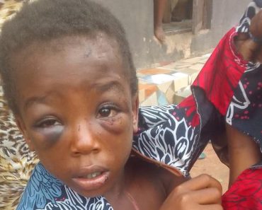 BREAKING: Edo commissioner vows to get justice for physically assaulted child