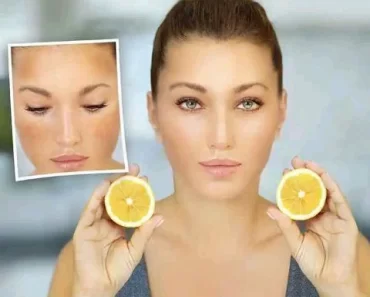Don’t Use Bleaching Cream See How To Get Clear Skin With Lemon Juice Without Side Effects
