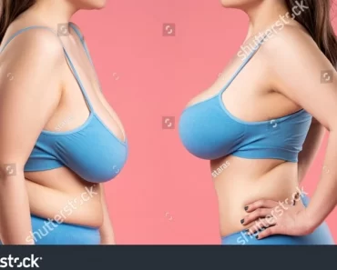 4 Habits That Can Cause Breast Sagging