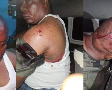 BREAKING: APC Thugs Allegedly Brutalised Brass Local Council PDP Chairman Over Election Materials (Photos)