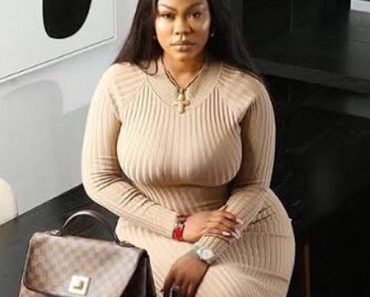 Popular Nollywood Actress Opens Up On Undergoing ‘Chin Implant’ Surgery