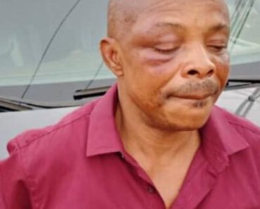 JUST IN: Ajaero in Critical Condition, His Right Eye at Risk in Imo Hospital